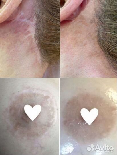 Татуаж бровей, межресничка, губы