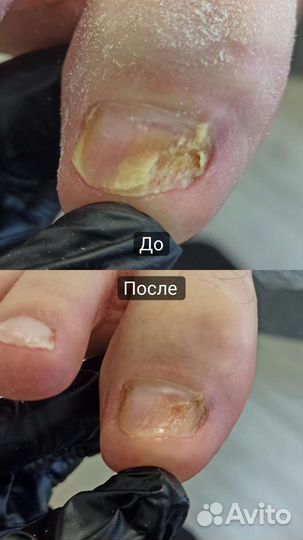 Подолог / мастер маникюра и педикюра