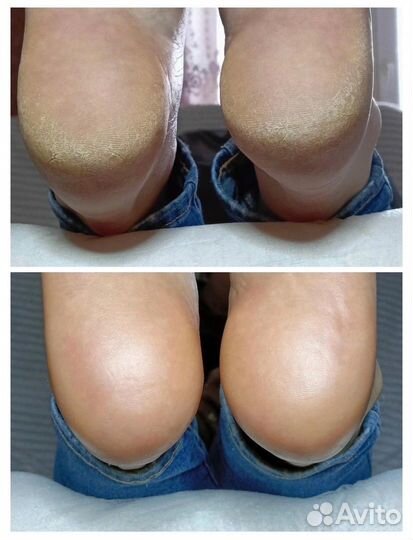 Маникюр гель-лак / Педикюр