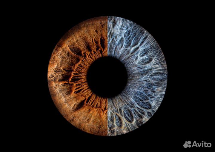 Фото радужки глаз 