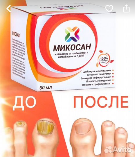 Крем от грибка ногтей и трещин