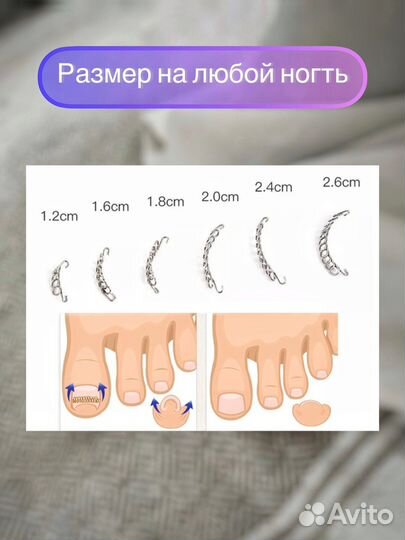 Корректор вросшего ногтя