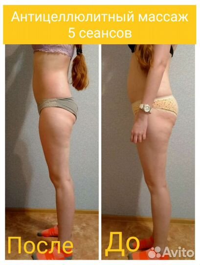 Оздоровительный и Антицеллюлитный массаж