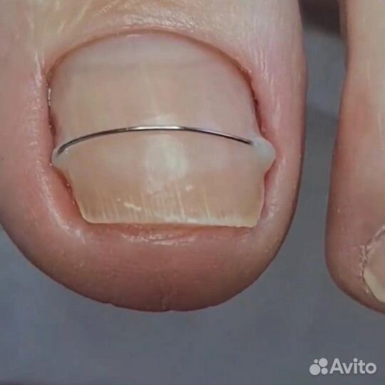 Услуги подолога