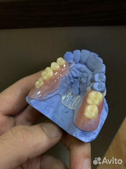 Зубной техник Реставрация и изготовления протезов