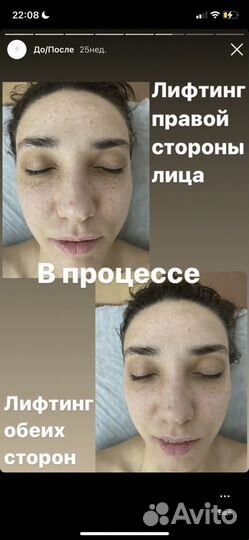 Хиромассаж Лица, Тела, Головы, Антистресс терапия