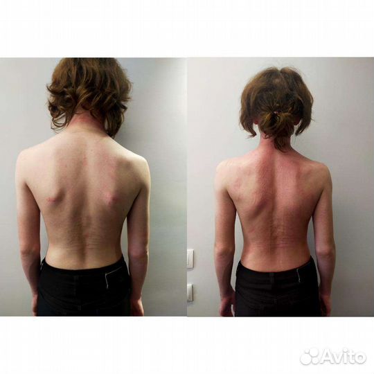 Детский массаж