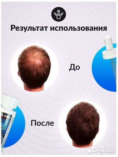 Миноксидил 5 оригинал для роста волос и бороды