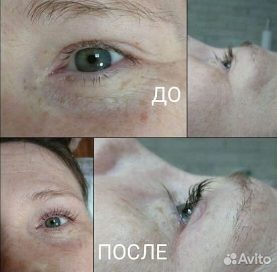 Ламинирование ресниц