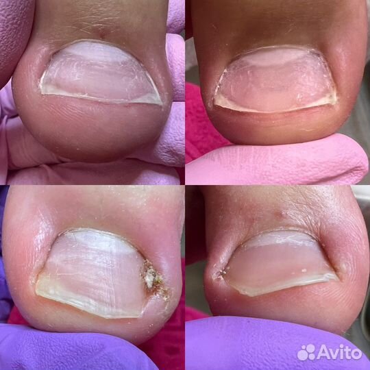 Услуги подолога