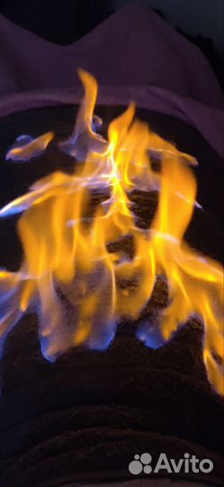 Массаж. лазерная эпиляция