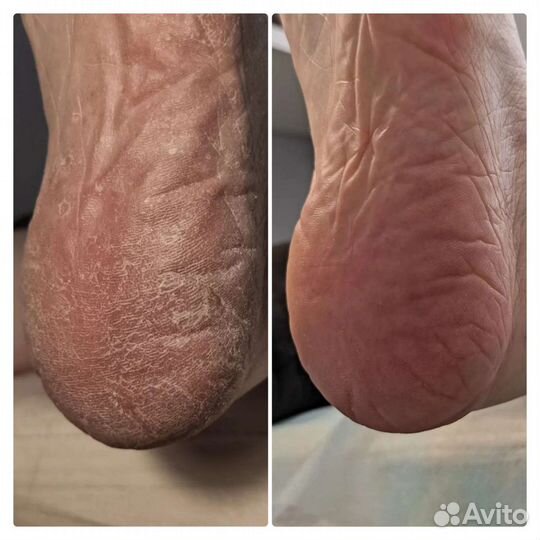 Маникюр, педикюр kart