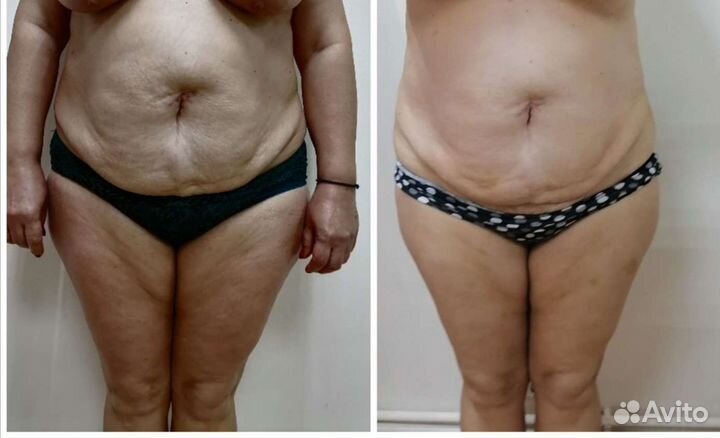 Косметология,коррекция фигуры