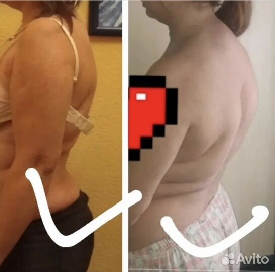 Выравнивание тела