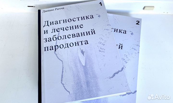 Диагностика и лечение заболеваний пародонта