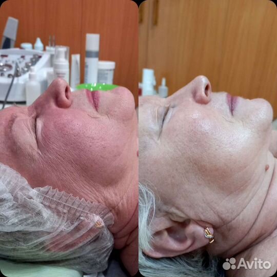 Услуги косметолога