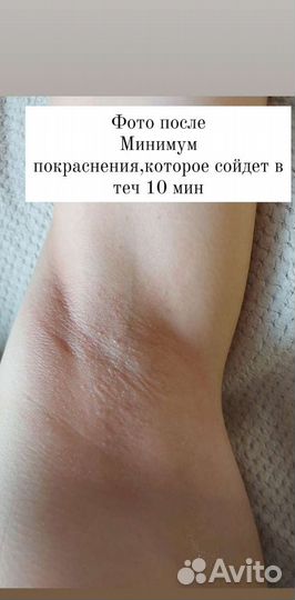 Эпиляция Депиляция Шугаринг Воск