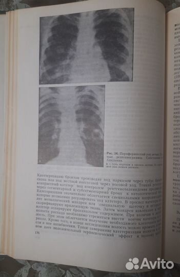 Опыт Советской медицины в Великой отечествен войне