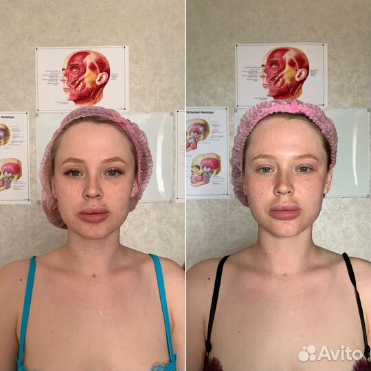 Миофасциальный массаж