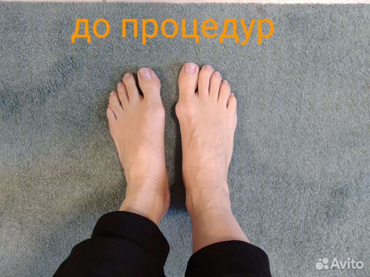 Массаж оздоровительный, миопрессура