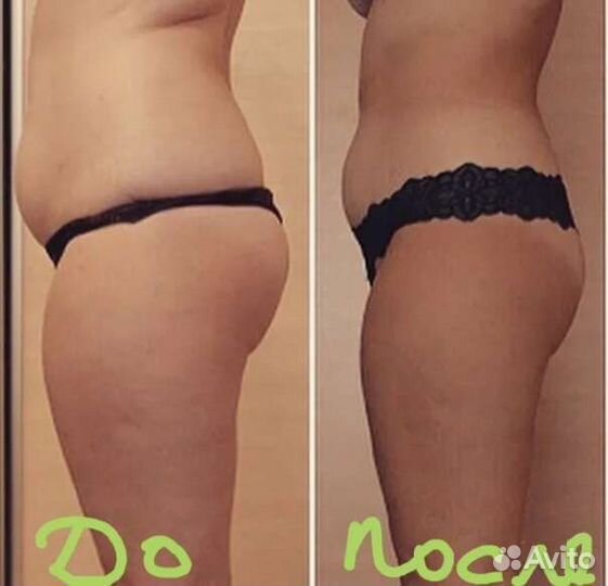 Косметология,коррекция фигуры