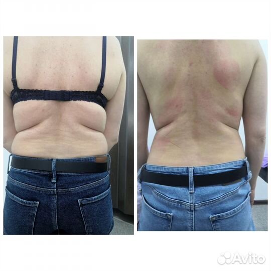 Худеем быстро и надолго