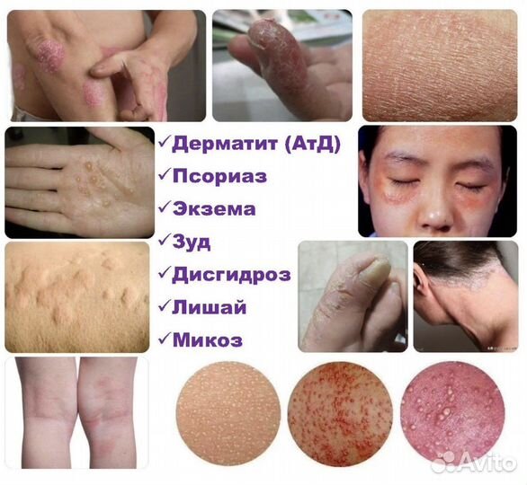 Мазь день - ночь Цицунь Басюань qicun baxian