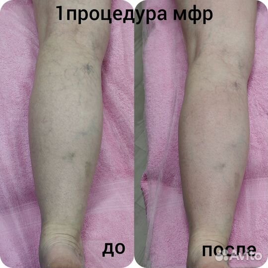 Массаж,женский мастер