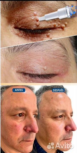 Домашнее косметическое средство для удаления Б и Р