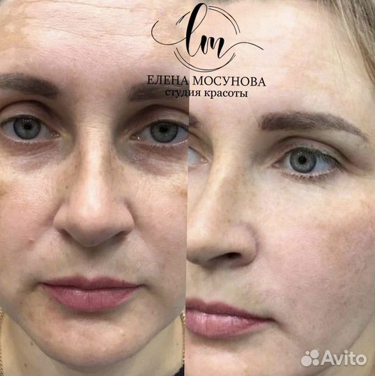 Массаж лица