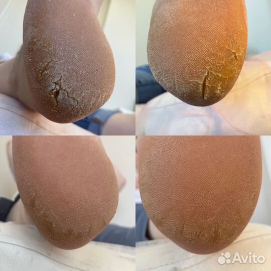 Наращивание ногтей / Подолог / Педикюр