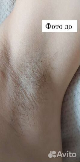 Эпиляция Депиляция Шугаринг Воск