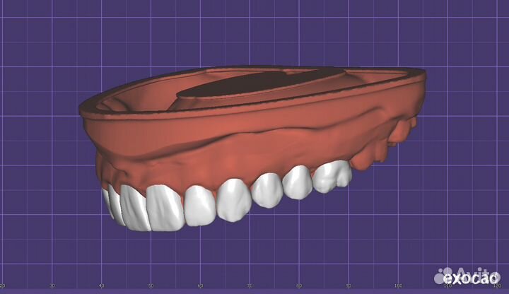 Моделирование в exocad зубной техник CAD CAM
