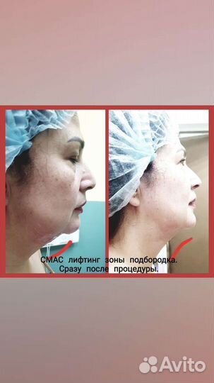 Массаж, коррекция фигуры, косметология