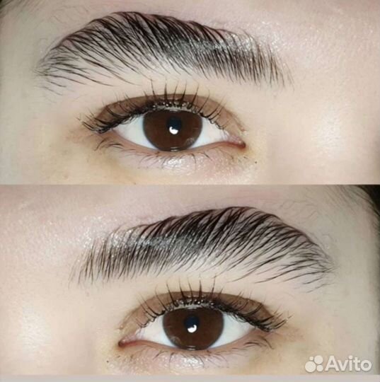 Татуаж, мезотерапия, ботокс, увеличение губ