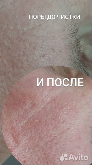 Косметолог/Чистки/Пилинги/Массаж лица