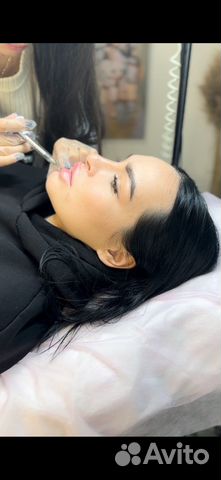 Увеличение губ / Косметолог