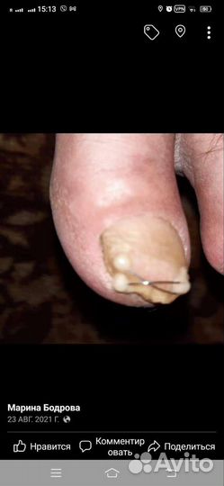 Подолог с опытом работы