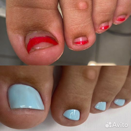 Мастер педикюра