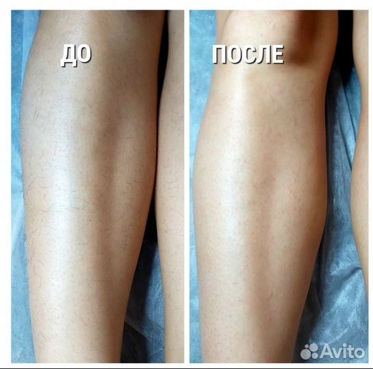 Спа-депиляция (сахар,воск), Кривко, Сосново