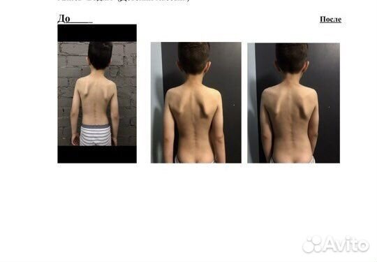 Детский массаж\лфк\консультация