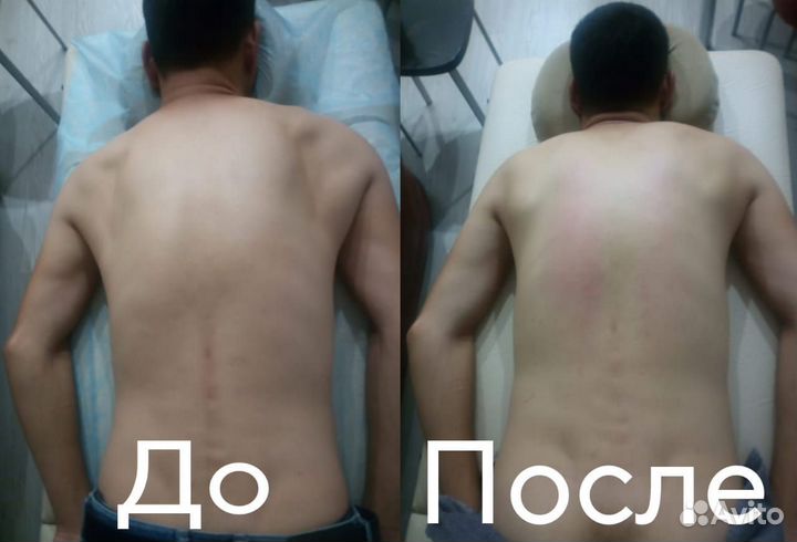 Массаж мануальный костоправ