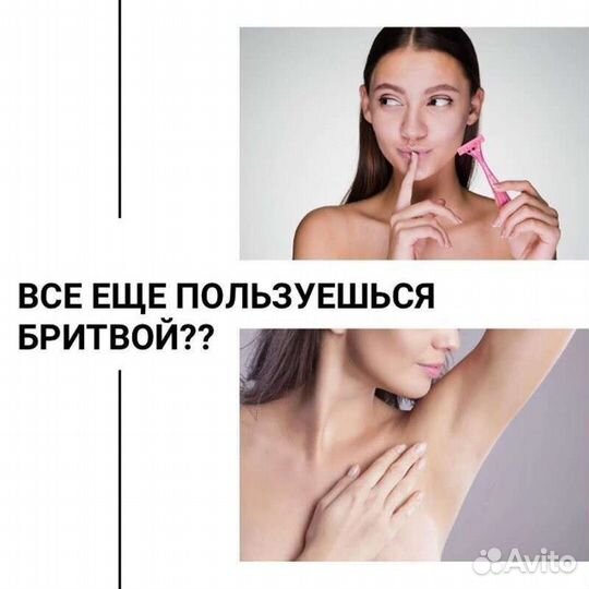 Лазерная эпиляция