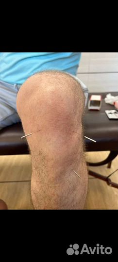 Костоправ - Кинезиолог -Массажист