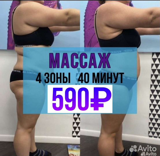 Массаж Vela Shape, круче чем LPG