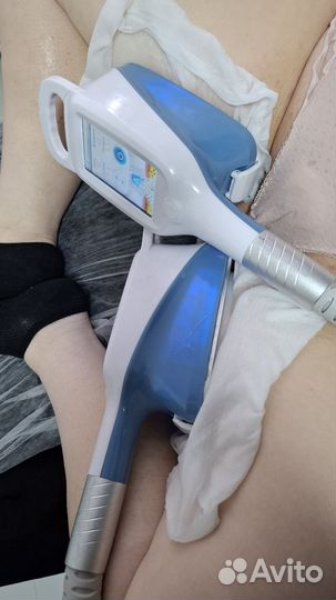 Модель на криолиполиз