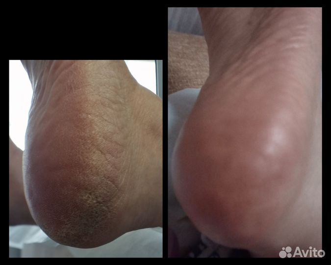 SMART Педикюр