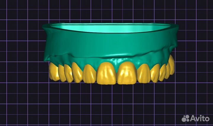 Моделирование в exocad зубной техник CAD CAM