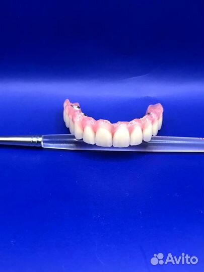 Прессовка протезов /Изготовление протезов