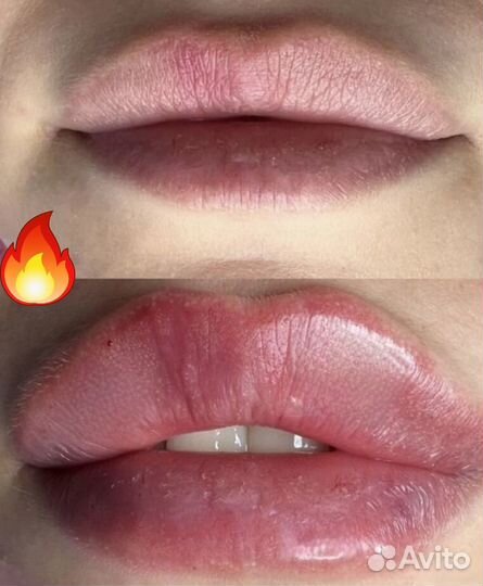 Услуги косметолога